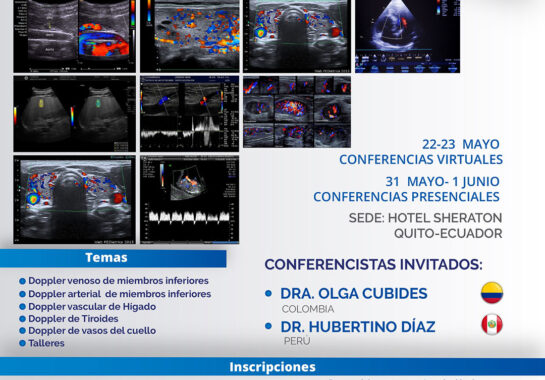 Curso Hands On de Doppler 2024